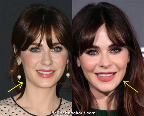 zooey deschanel facelift|Zooey Deschanel Plastic Surgery: Facts and Myths ...